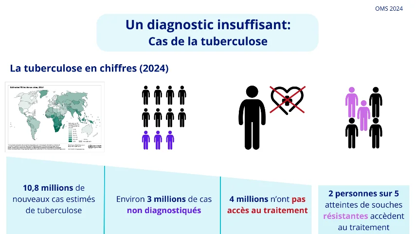 Infographie diagnostic insuffisant de la tuberculose